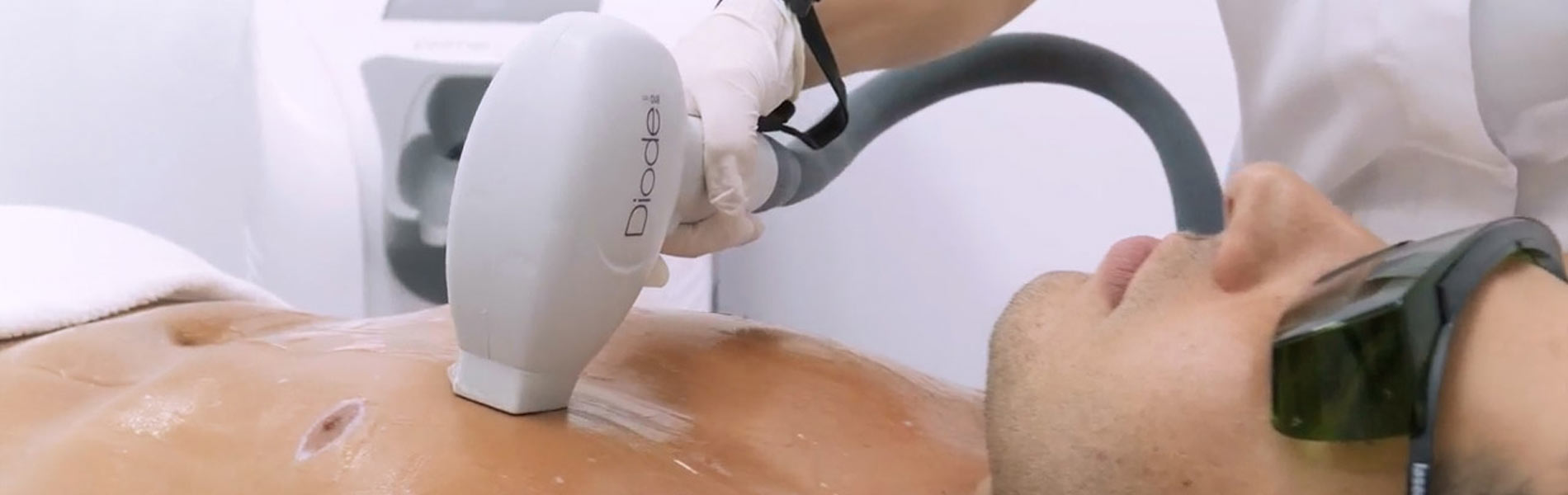 Laser Hair Removal - Galway
